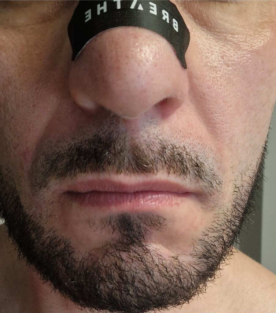 Obrazek #1 z Anonim